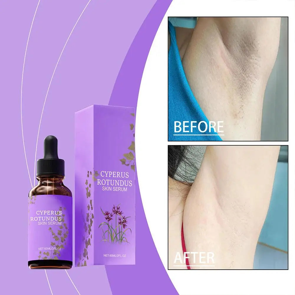 Hair Removal Serum Removal Essence Reduce Armpit Arms Body Hair Inhibitor Shrink Pores Smooth Skin Care Serum Body Cream Care